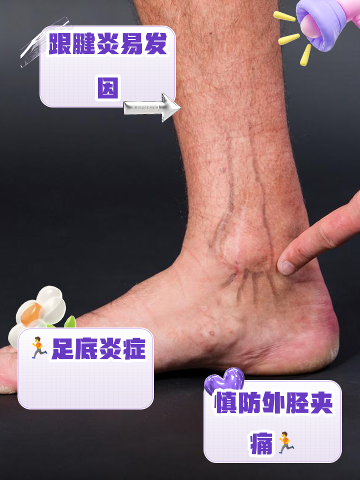 米兰网址-关于运动伤害最常见TOP5及预防方法的信息